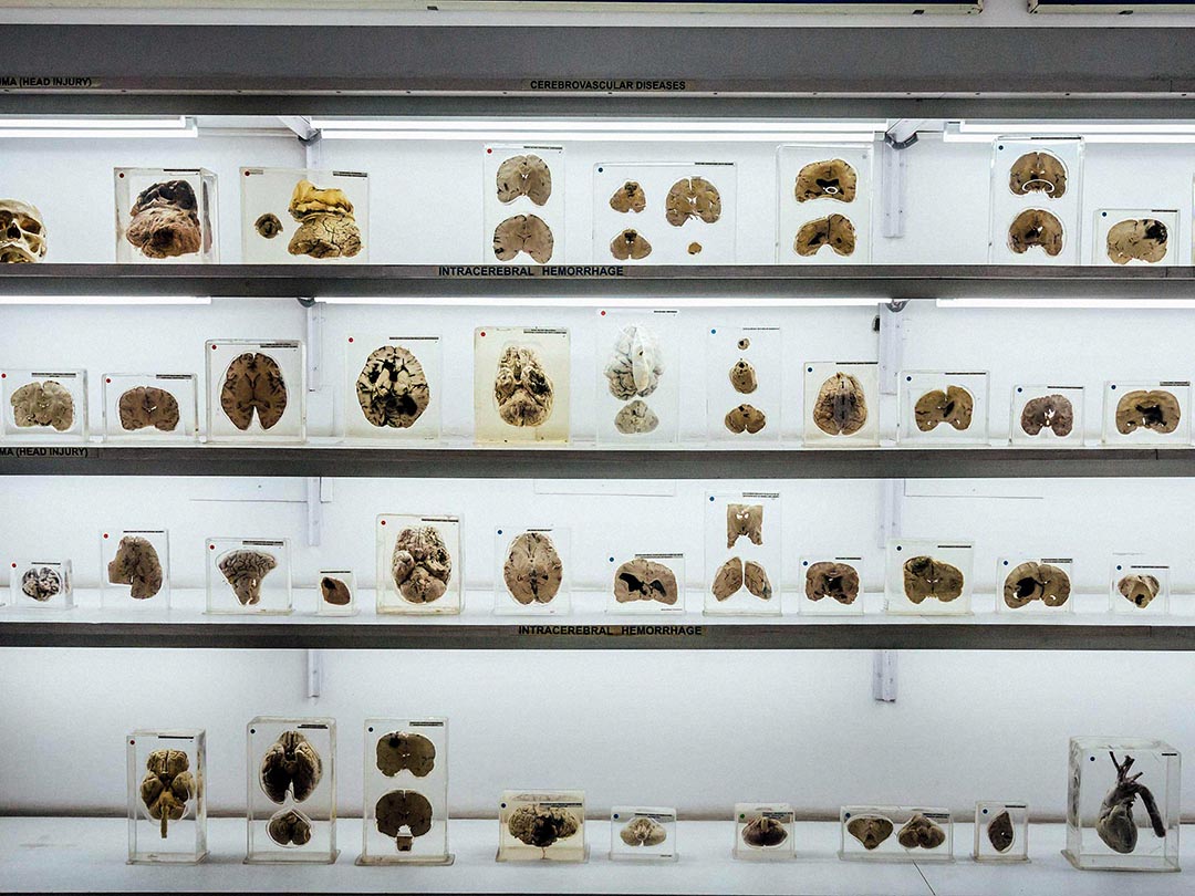 Nimhans Brain Museum